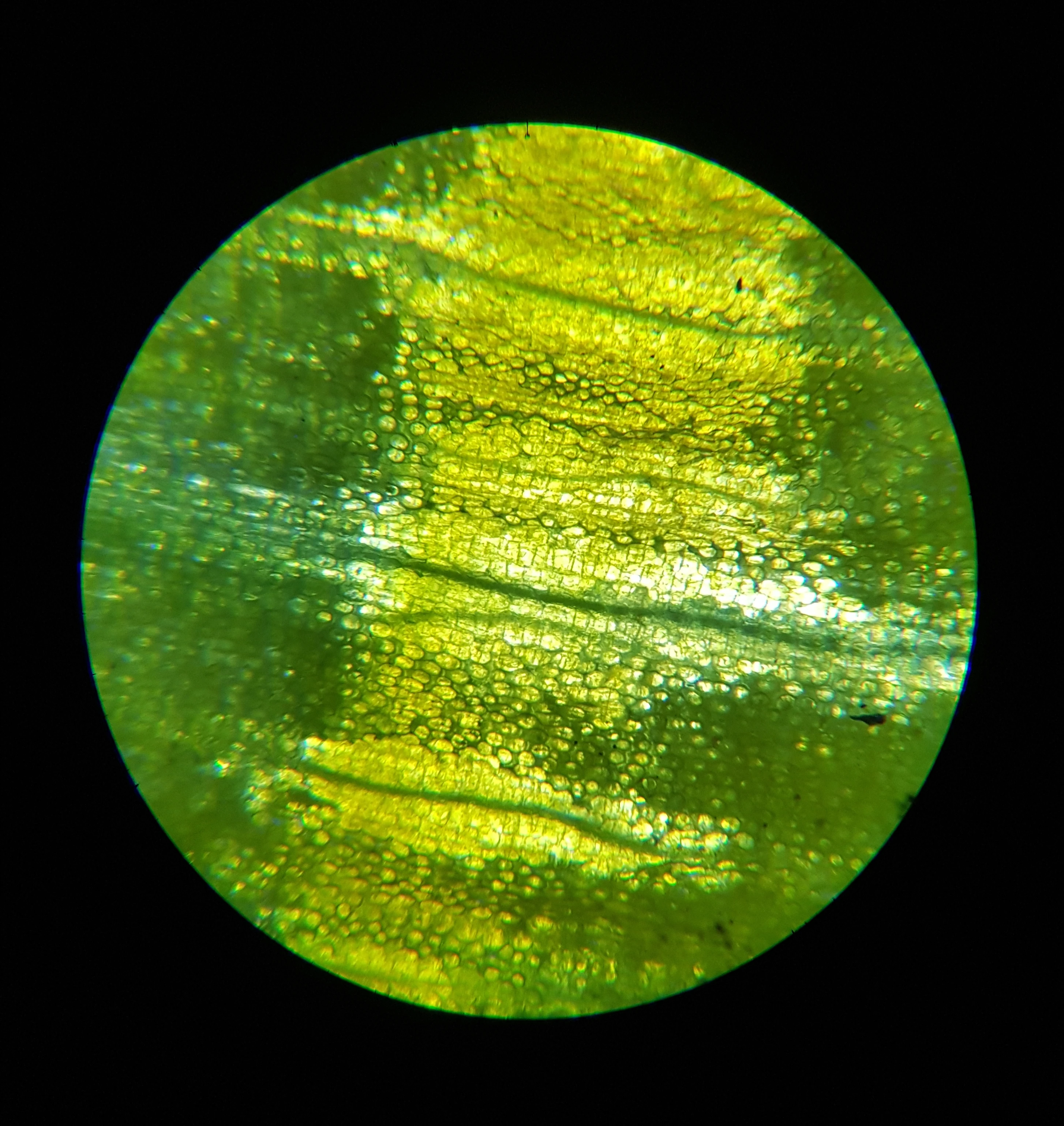 #30 PARENCHYMA CE
