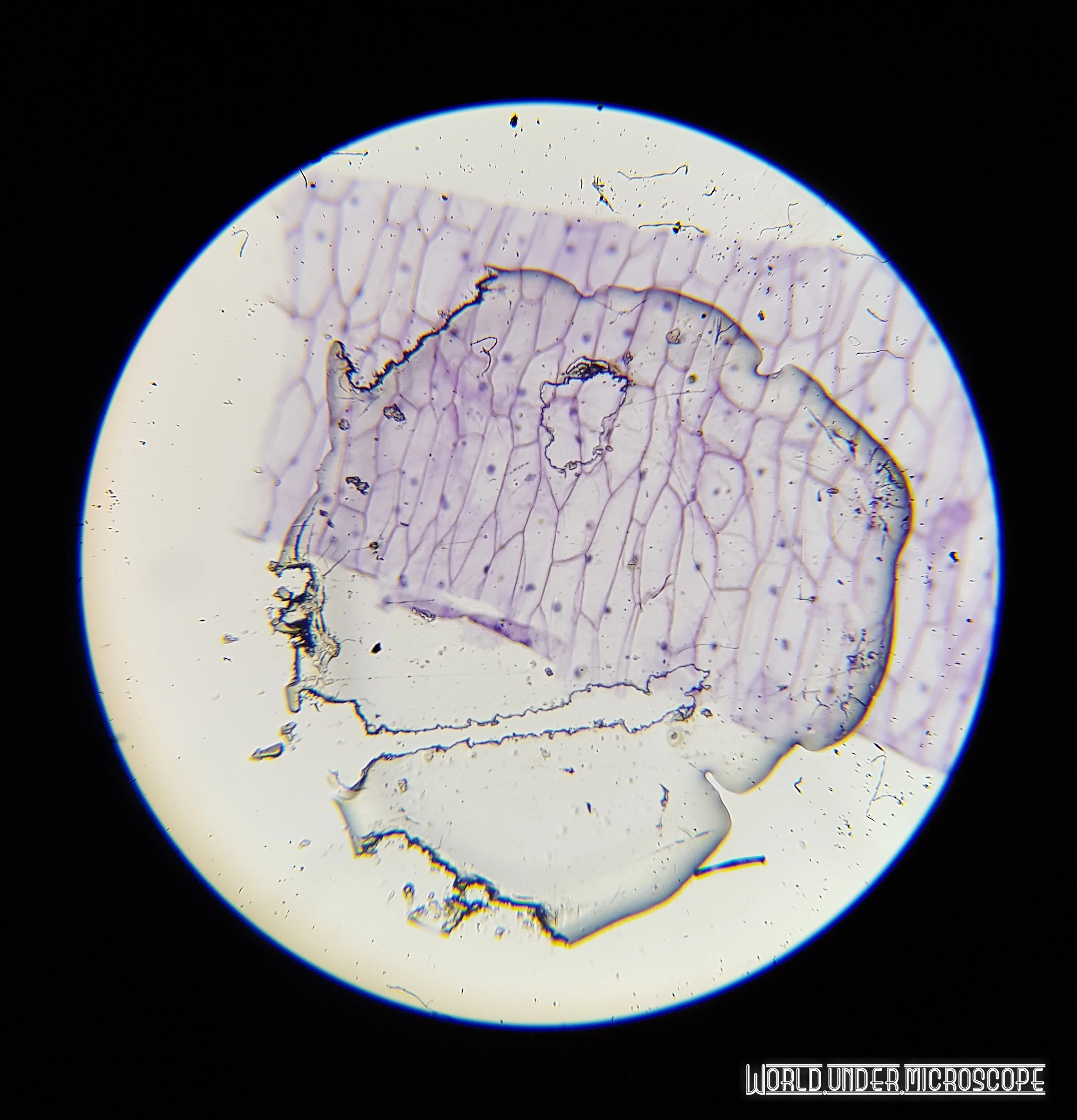 #21 EPIDERMIS